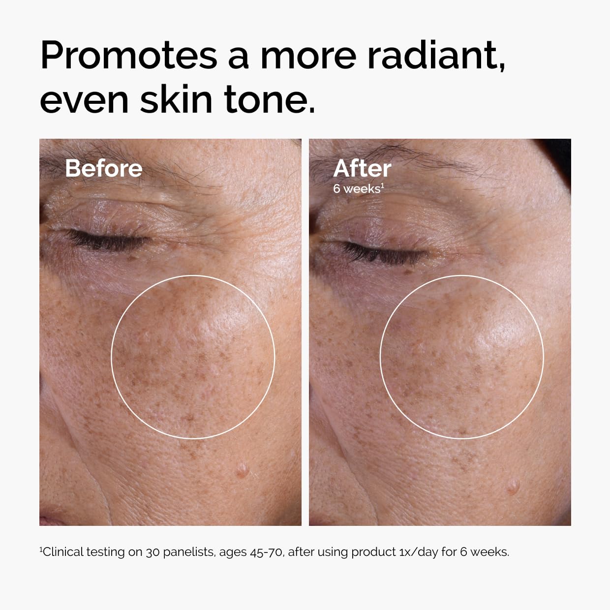 The Ordinary Glycolic Acid 7% Exfoliating Toner, Brightening and Smoothing Daily Toner for More Even-Looking Skin Tone - Image 2