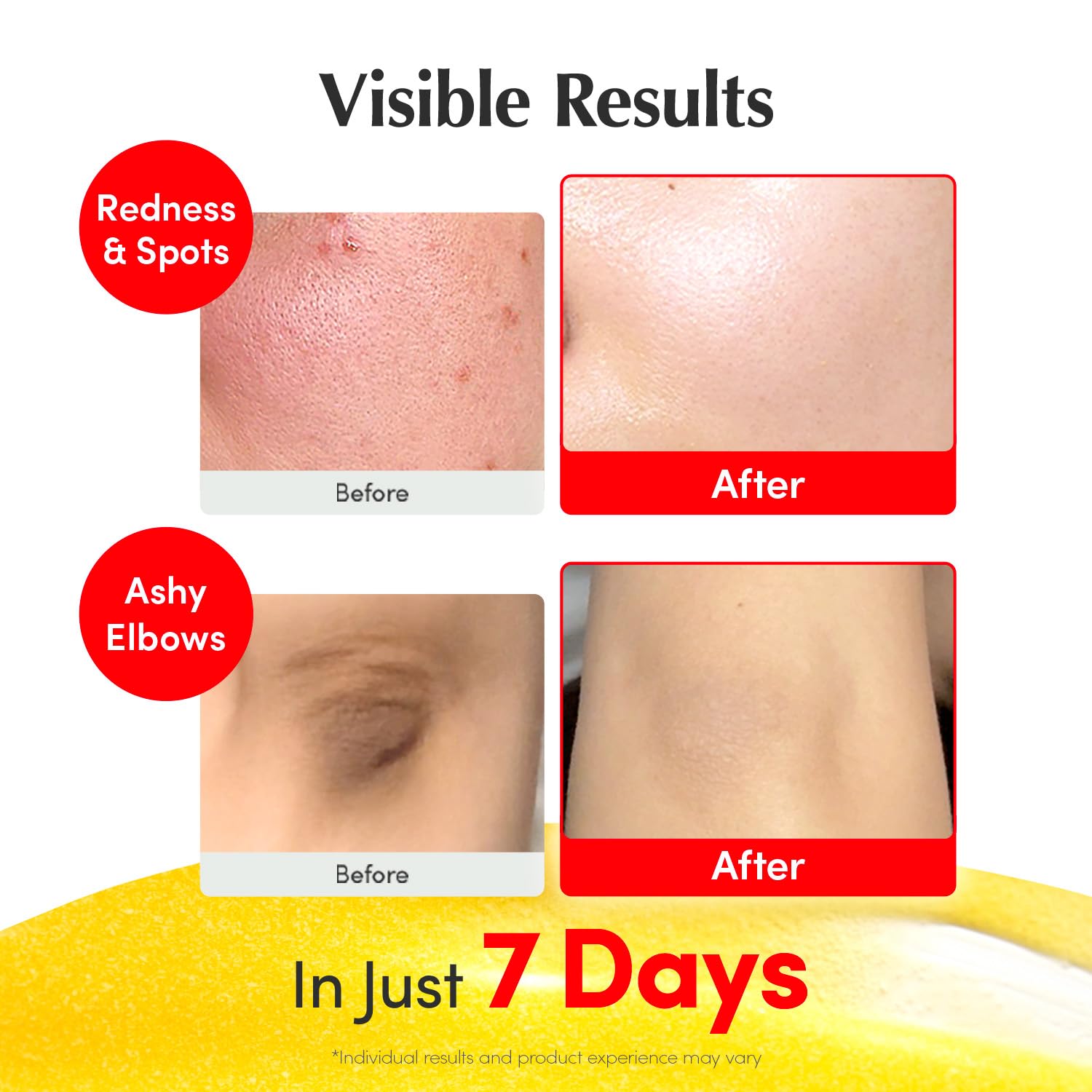 EQQUALBERRY Vitamin Illuminating Serum | Niacinamide 4% & TXA | Brightening Vitamin C Serum for Face Glow with Hyaluronic Acid | Dark Spot & Uneven Tone Care | Korean Skincare, 1.01 fl oz - Image 4